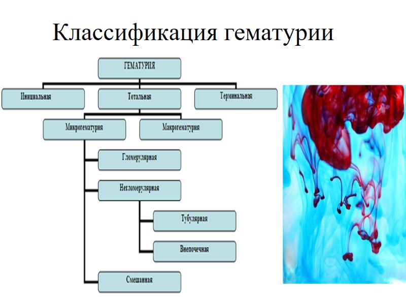 Классификация гематурии